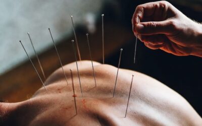 BDSM : c&rsquo;est quoi le needle play ?